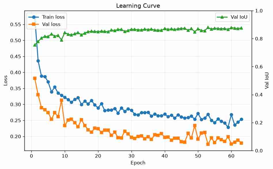 Training and validation loss curves plus validation IoU over 250 epochs
